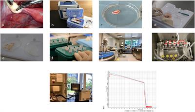 Editorial: Fertility preservation in the pediatric and adolescent populations, volume II